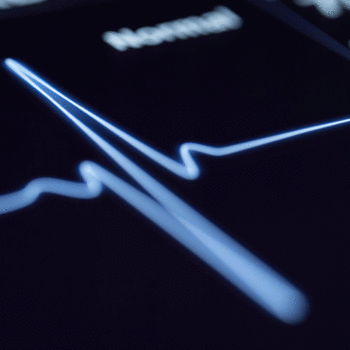 هوش مصنوعی احتمال دچار شدن به حمله قلبی را پیش‌بینی می‌کند