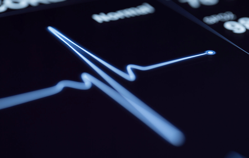 هوش مصنوعی می تواند حمله قلبی را پیشگویی کند .