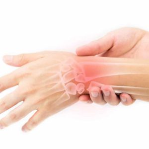 علائم در رفتگی مچ دست چیست؟ راهکارهای درمانی
